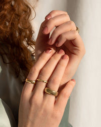 [[Farbe:Gold]]