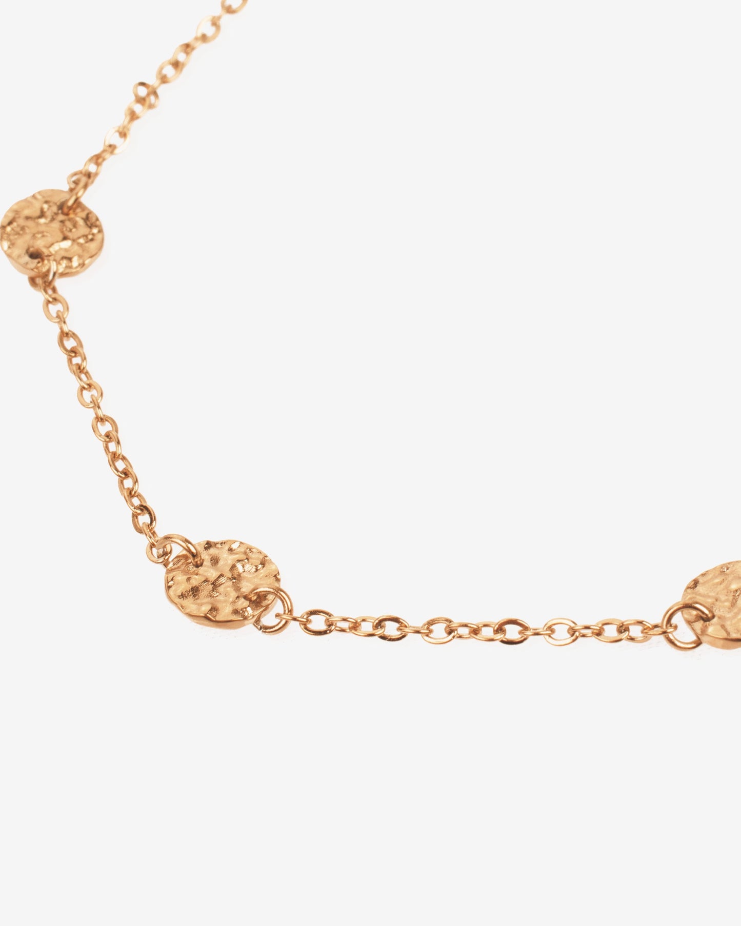 [[Color:Rose Gold]]